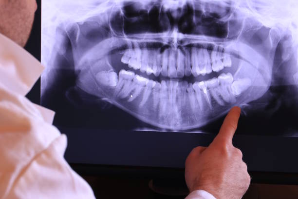 Best Emergency Broken Tooth Repair in USA